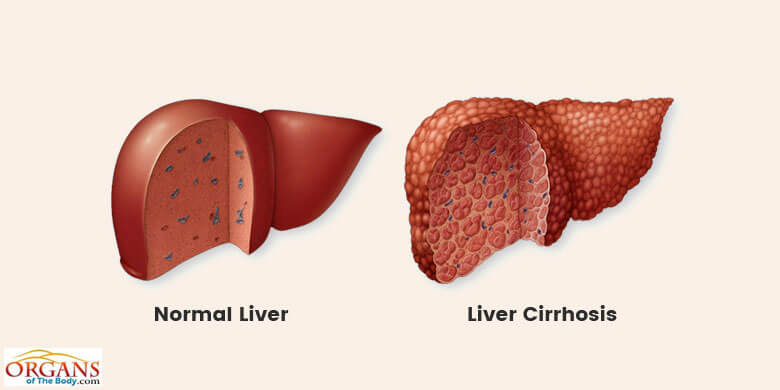 Human Liver Anatomy, Function, Location, Parts & Diseases