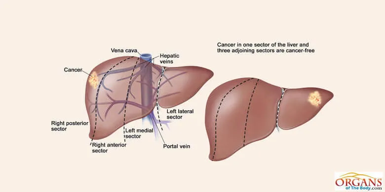 Types Of Liver Diseases And Disorders In Human Beings