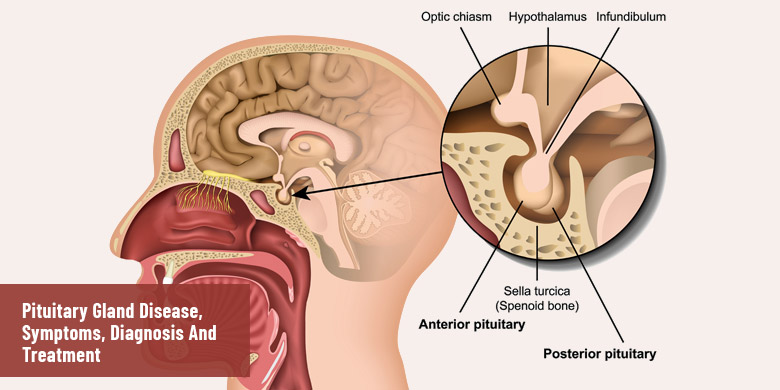 List Of Pituitary Gland Disease 